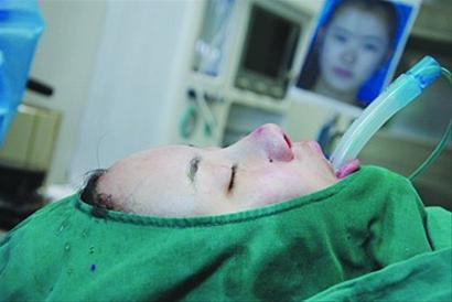 妙齡女沒當上空姐發(fā)誓整容 砸15萬挨11刀