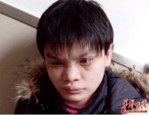 近日，十堰市兒童福利院被曝虐待兒童，其中7名兒童在2012年冬季被活活凍死，引發(fā)廣泛關(guān)注。 網(wǎng)絡(luò)截圖